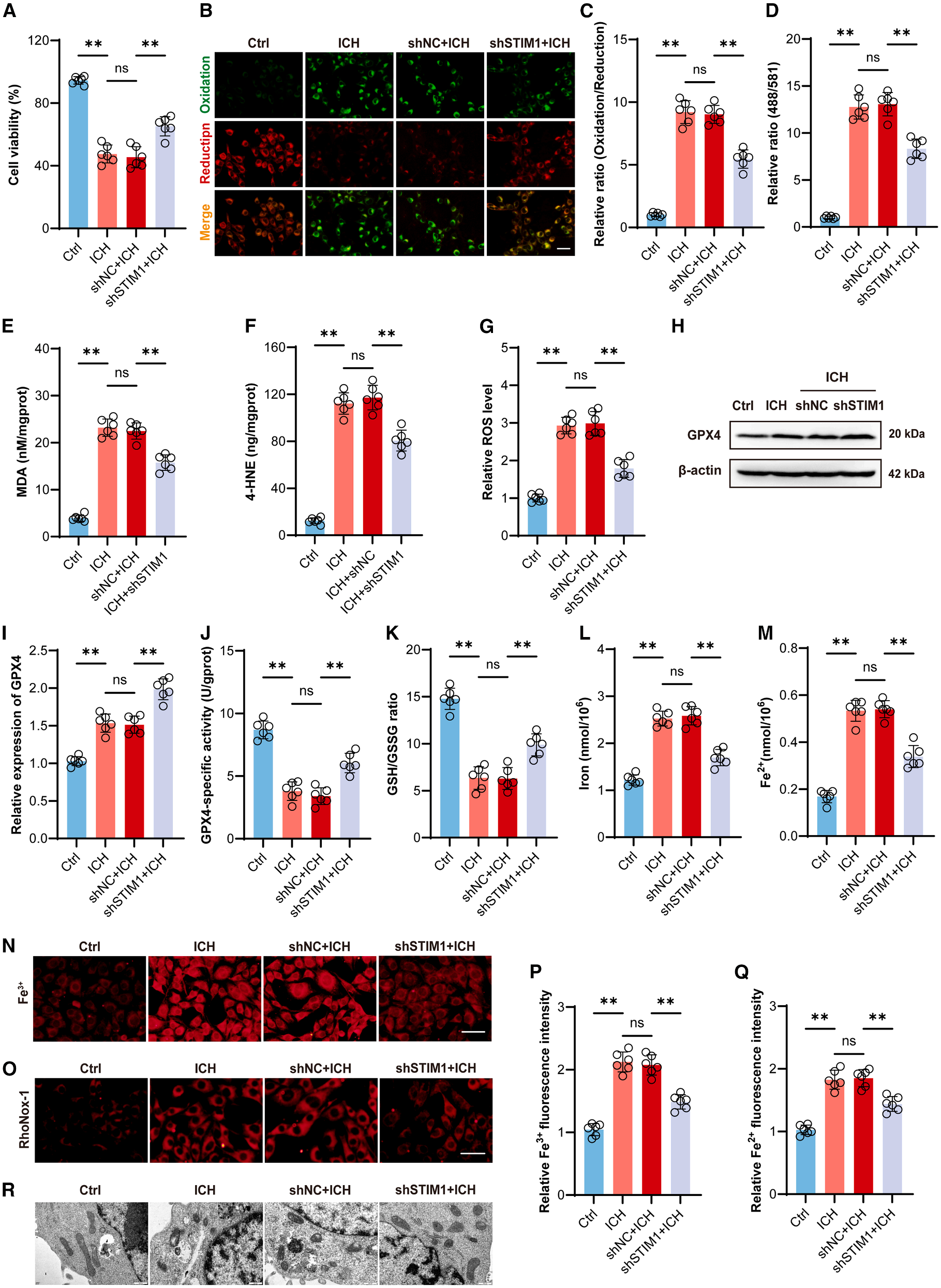 STIM1 regulates iron homeostasis and promotes neuronal ferroptosis to aggravate cerebral hemorrhage